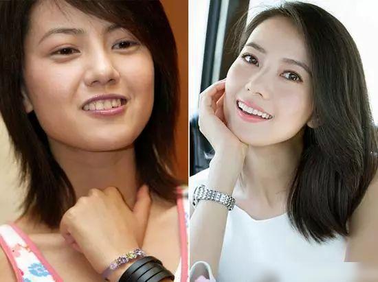 明星牙视频,明星们的口腔护理秘籍大公开